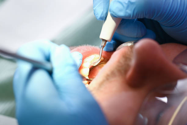 Best Emergency Treatment for Toothache in Hitchcock, TX