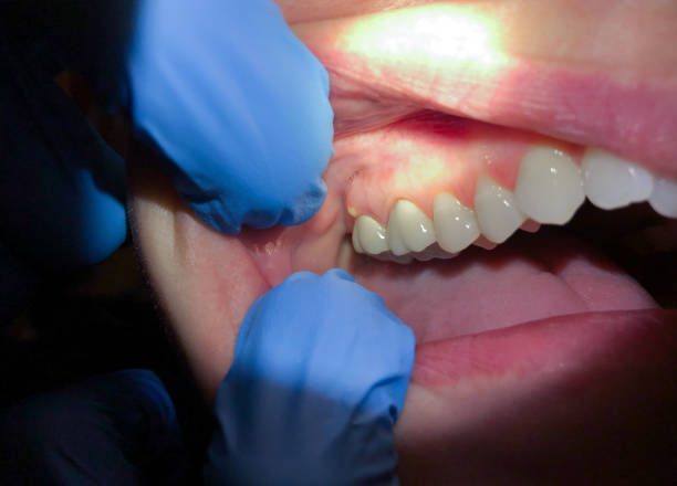 Best Weekend Emergency Dentist in Hitchcock, TX